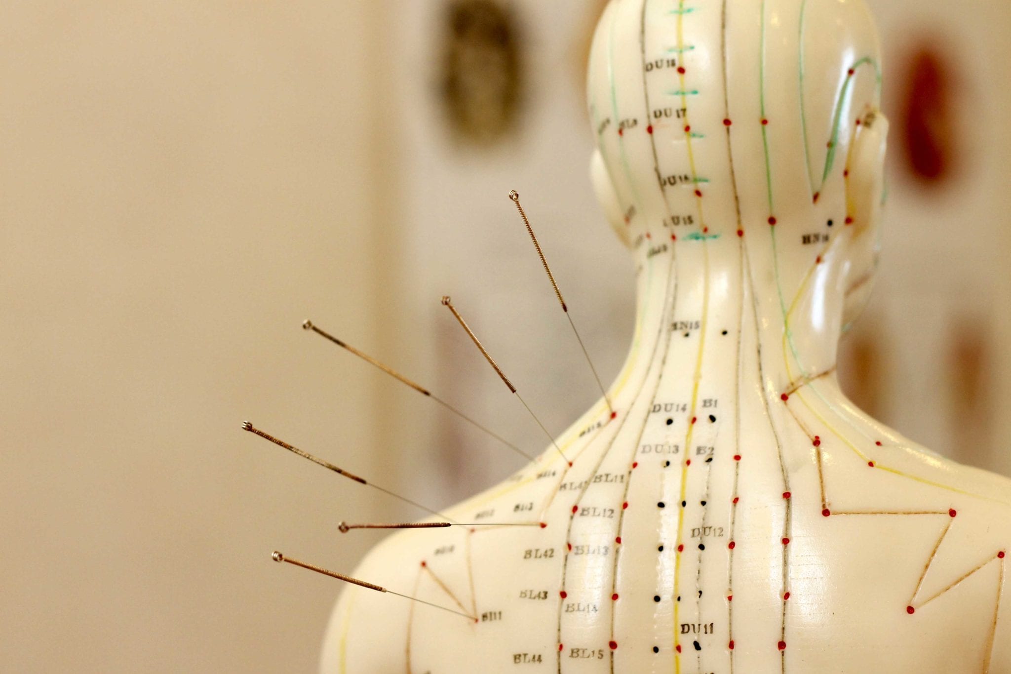Acupuncture-Chart-and-Meanings.jpg